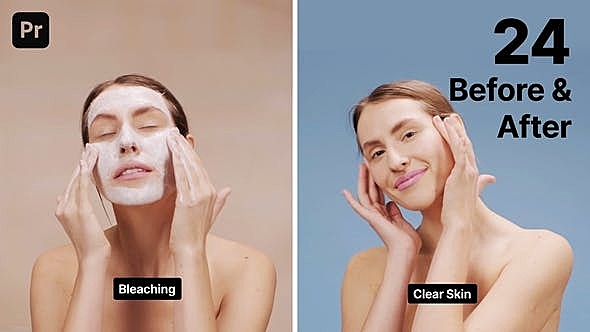 PR预设-视频图片对比滑动展示之前之后反差模板-Before and After